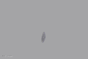 <i>Encyonopsis microcephala</i> (Grunow) Krammer, 1997 © D. Milan